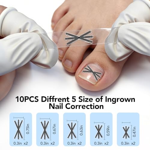 Ingrown Toenail Corrector Strips