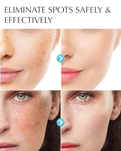Dark Spot Remover For Face And Body